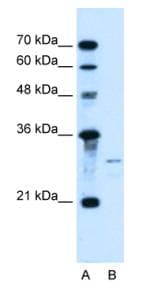 Polyclonal Rabbit anti-Human SHH / Sonic Hedgehog Antibody (N-Terminus, IHC, WB)