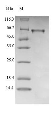 Mouse CYP27B1 Protein (Recombinant 6His, N-terminus)