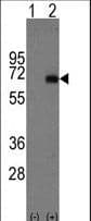 Alpha-Fetoprotein Antibody (aa300-329)