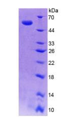 Human SPR Protein (Recombinant His-GST)