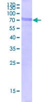 Human TDP-43 / TARDBP Protein (Recombinant GST)