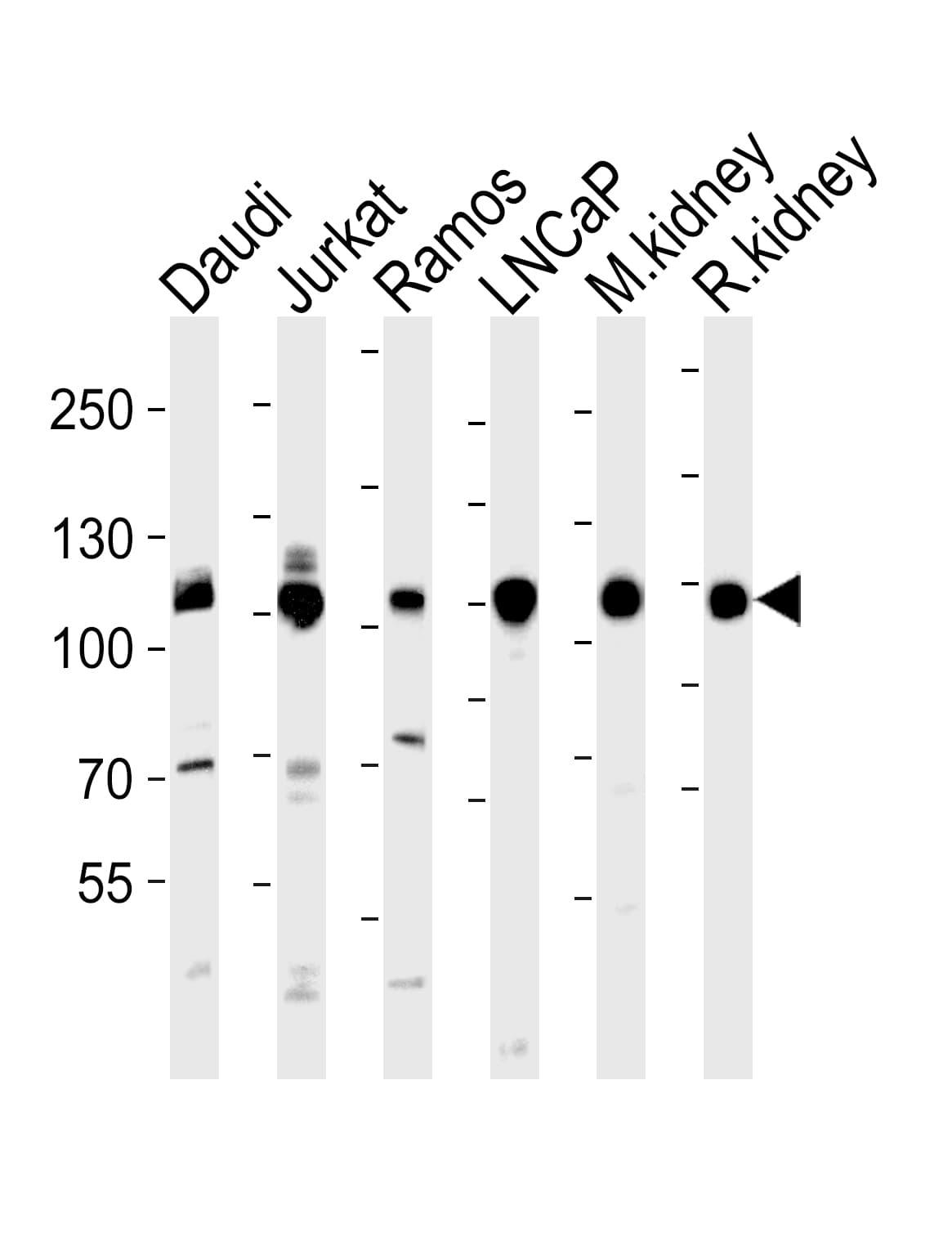 Polyclonal Rabbit anti-Human MME / CD10 Antibody (aa492-525, WB)