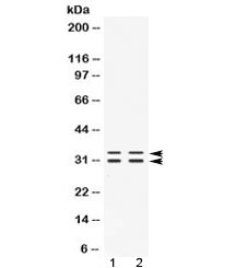 Polyclonal Rabbit anti-Human FHL3 Antibody (WB)