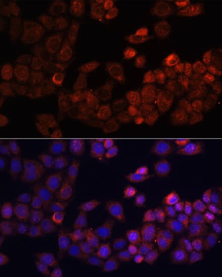 FAK / Focal Adhesion Kinase Antibody