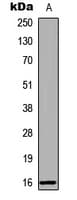 Polyclonal Rabbit anti-Human RBP5 Antibody (N-Terminus, IHC, IF, WB)
