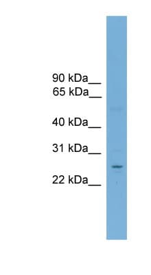 NR6A1 / GCNF Antibody (aa323-372)