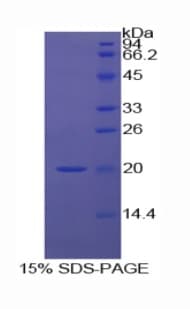 Human MDK / Midkine Protein (Recombinant His-S)