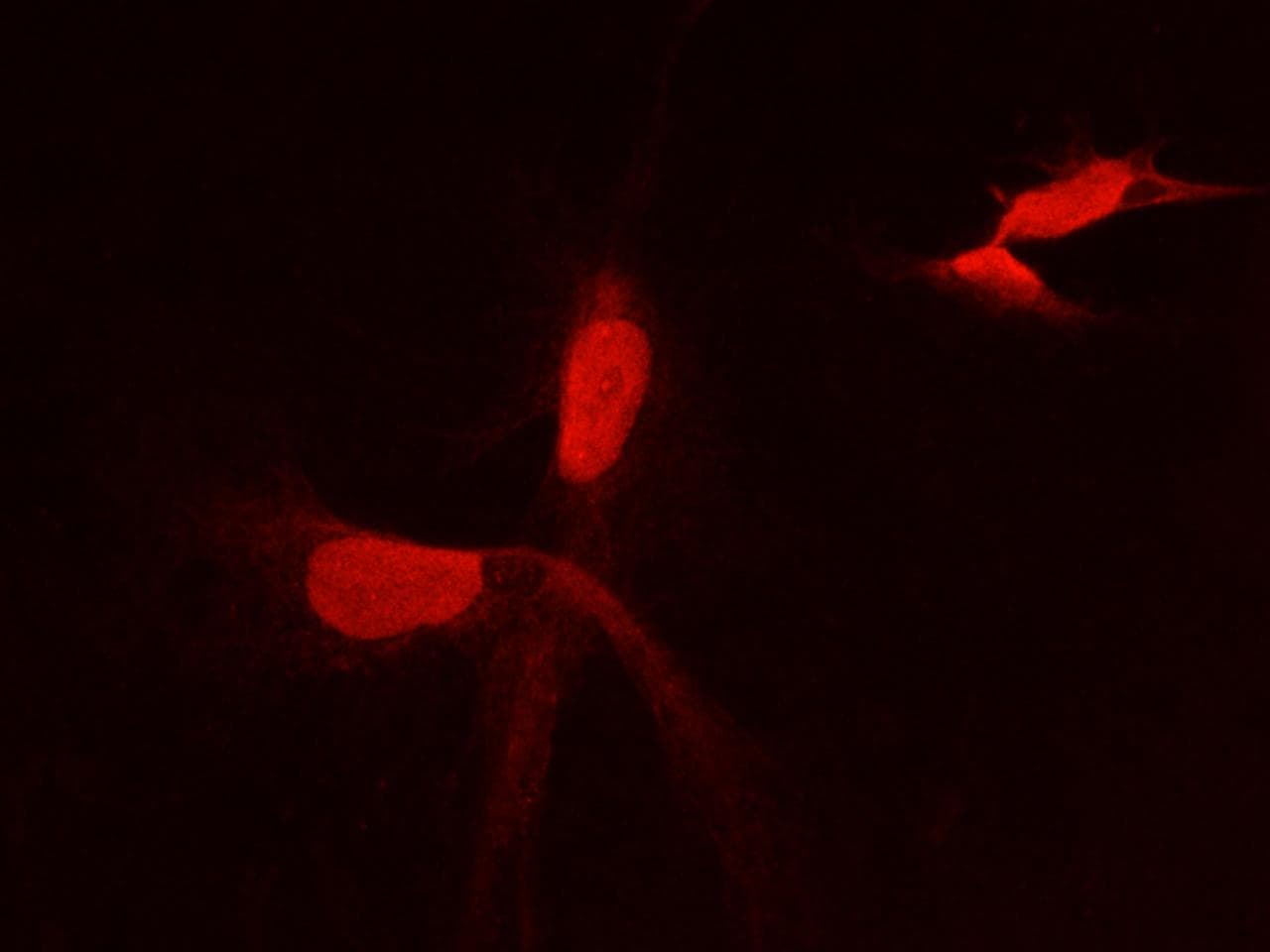 PFDN2 Antibody (clone 04, Preservative Free)