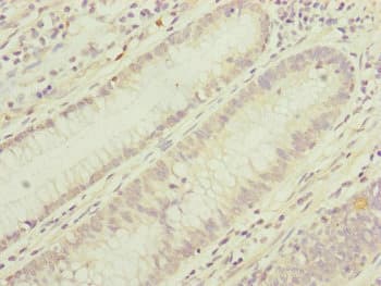 TIMM17B Antibody