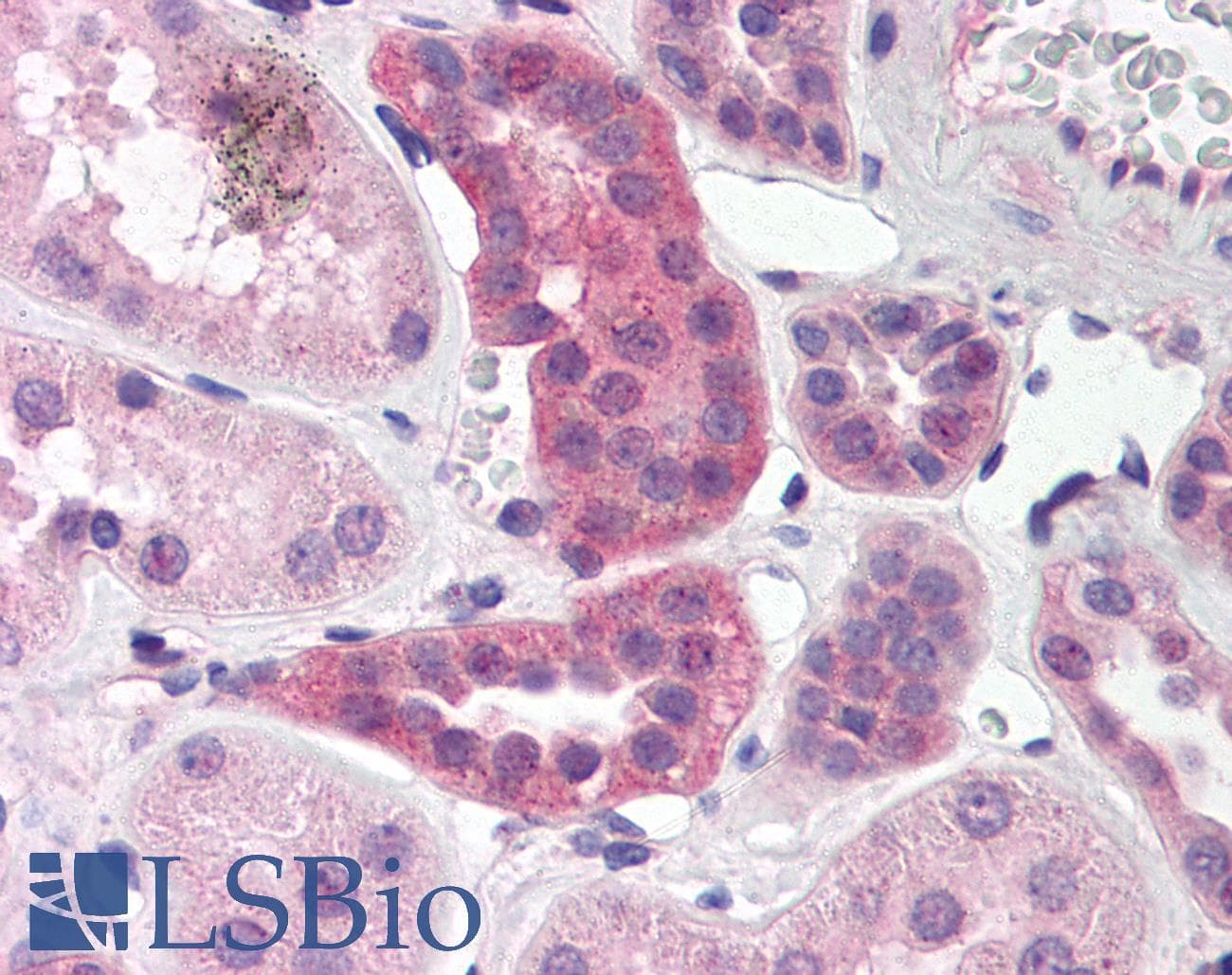 IHC-plus™ Polyclonal Rabbit anti-Human RPAIN Antibody (IHC, WB)