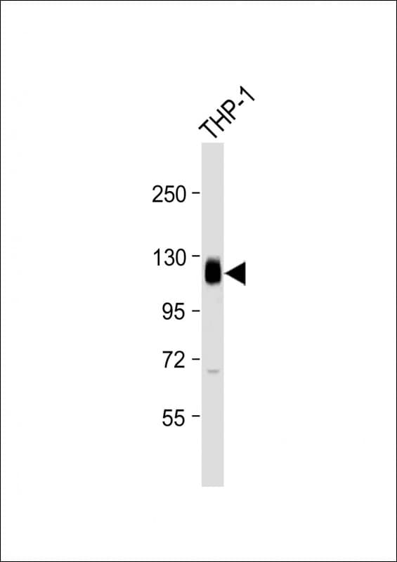 Polyclonal Rabbit anti-Human THBD / CD141 / Thrombomodulin Antibody (N-Terminus, WB)