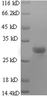 Human TGFB2 / TGF Beta2 Protein (Recombinant 6His, N-terminus)