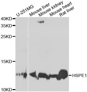 Polyclonal Rabbit anti-Human HSPE1 / HSP10 / Chaperonin 10 Antibody (IHC, IF, WB)