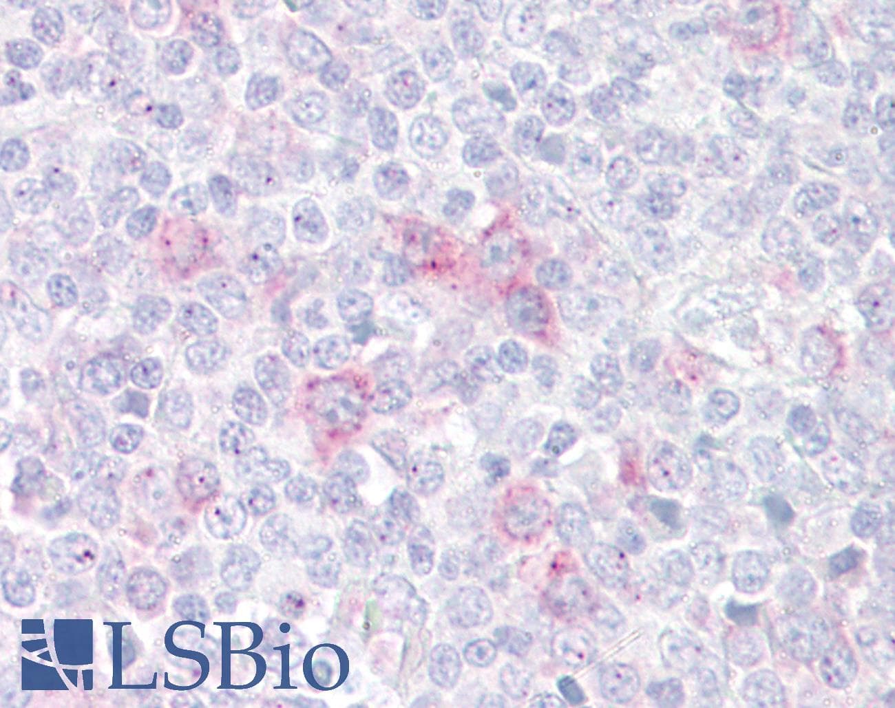 IHC-plus™ SIGLEC7 / CD328 Antibody (aa1-30)