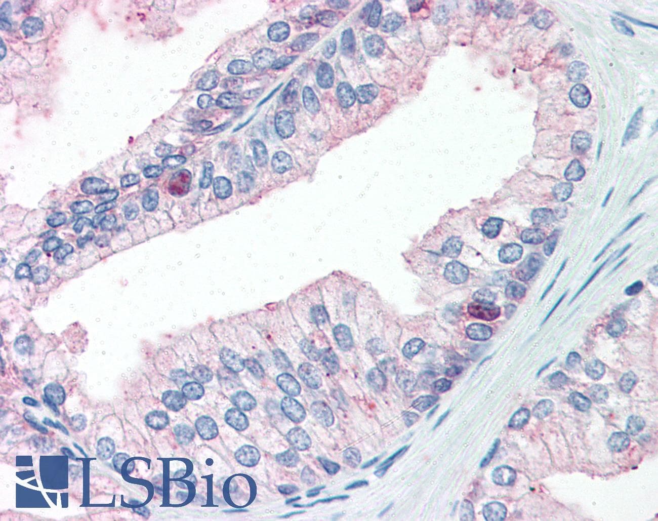 IHC-plus™ Monoclonal Mouse anti-Human FOLH1 / PSMA Antibody (C-Terminus, IHC, WB)