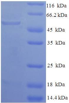 Human GPD1 Protein (Recombinant His-SUMO)