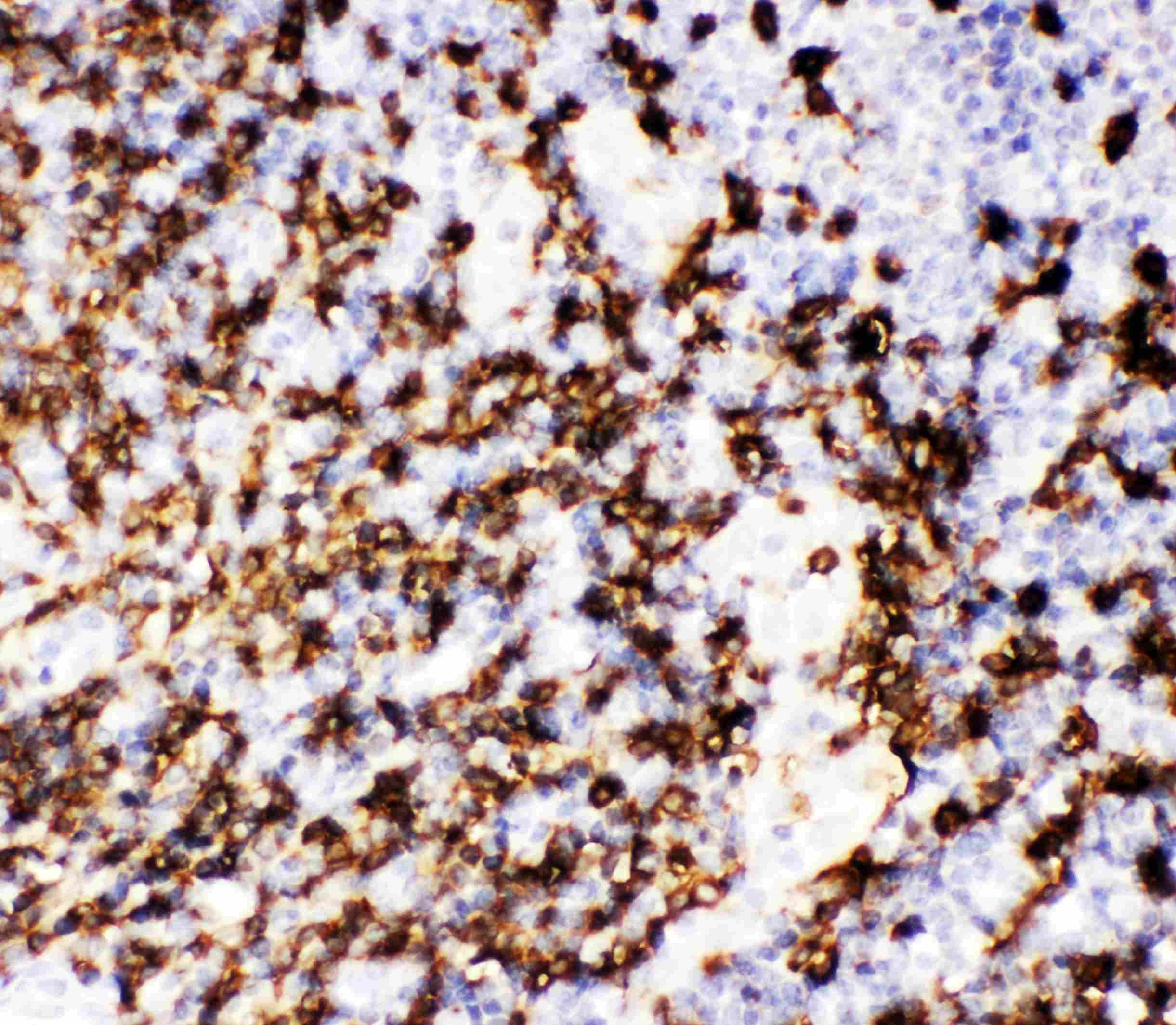 Polyclonal Rabbit anti-Human CD20 Antibody (aa1-261, IHC, WB)
