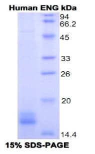 Human CD105 Protein (Recombinant His, N-Terminal)