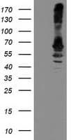 RPN1 / Ribophorin I Antibody (clone OTI6F2)