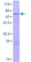 Human CD36 Protein (Recombinant GST)