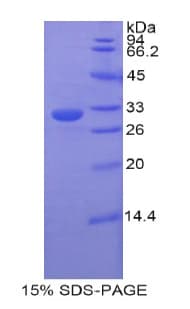 Rat ETFA Protein (Recombinant His-T7)