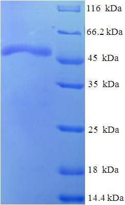 E. coli serB Protein (Recombinant His-SUMO)