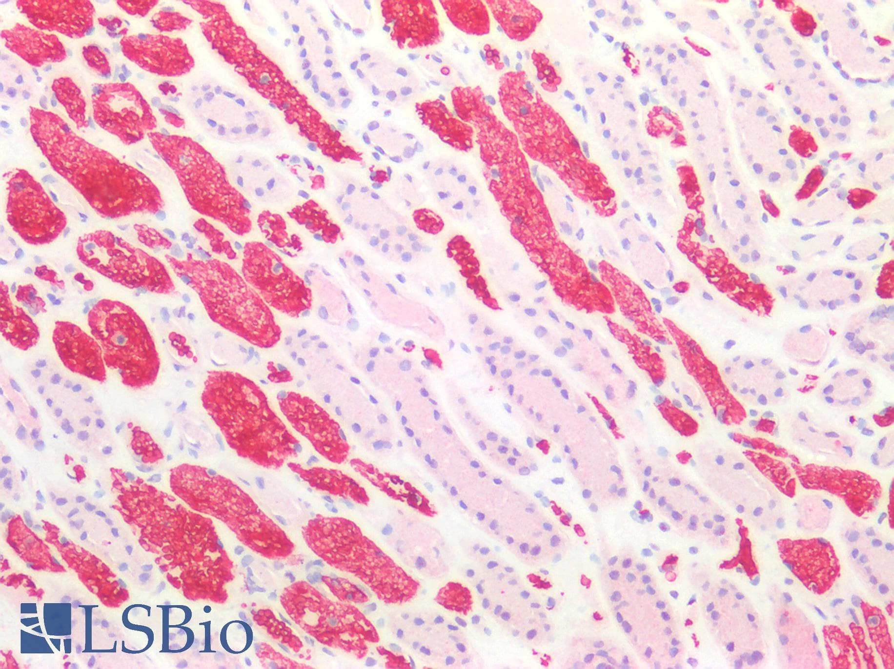 IHC-plus™ BCL2L1 / BCL-XL Antibody (aa1-208)