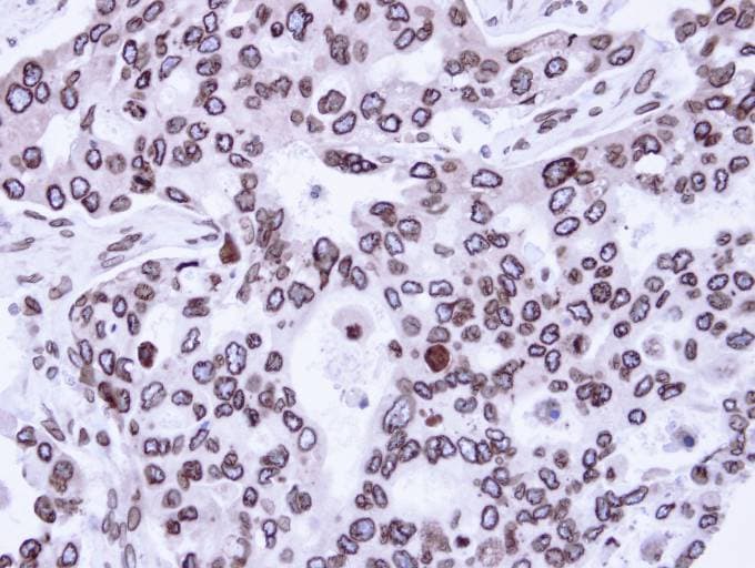 LMNA / Lamin A+C Antibody (aa59-572)