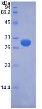 Human PINK1 Protein (Recombinant His-T7)