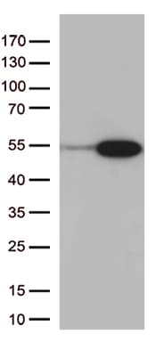 PDX1 Antibody (clone OTI7F7)