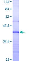 Human GAA / Alpha-Glucosidase, Acid Protein (Recombinant GST, N-terminus)
