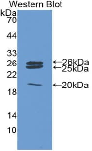 CAT / Catalase Antibody (aa401-523)