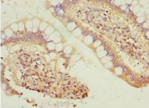 Polyclonal Rabbit anti-Human SIVA1 / SIVA Antibody (IHC)
