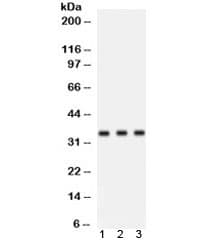 Polyclonal Rabbit anti-Human CCND1 / Cyclin D1 Antibody (WB)