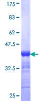 Human PAK3 Protein (Recombinant GST, N-terminus)
