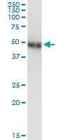 NR2F1 / Coup-TF Antibody (clone 1A4)