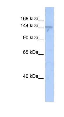 ZMYND8 / RACK7 Antibody (aa36-85)