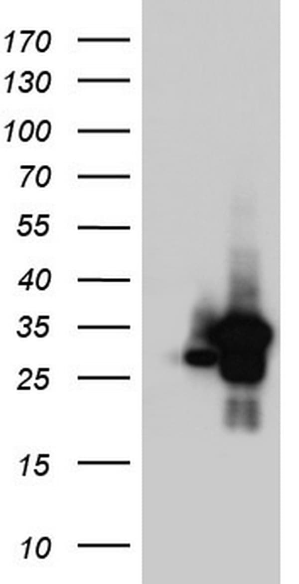 C14orf166 Antibody (clone OTI2D6)