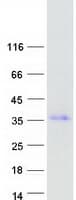 Human PAX8 Protein (Recombinant Myc-DDK (Flag))