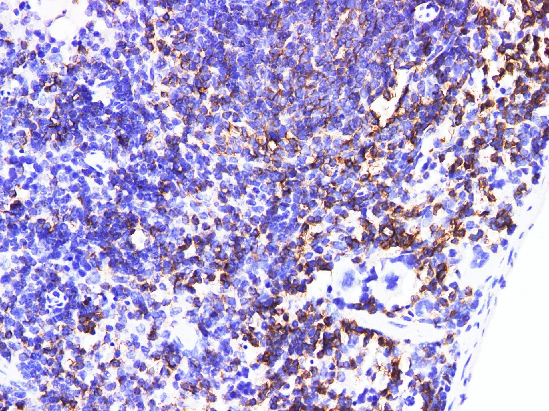 IL6R / IL6 Receptor Antibody
