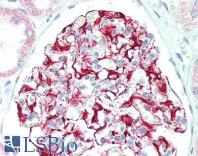 IHC-plus™ DIXDC1 Antibody (aa100-150)