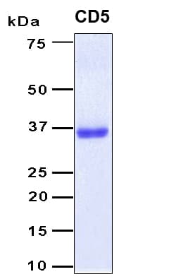 Human CD5 Protein (Recombinant 6His, N-terminus)