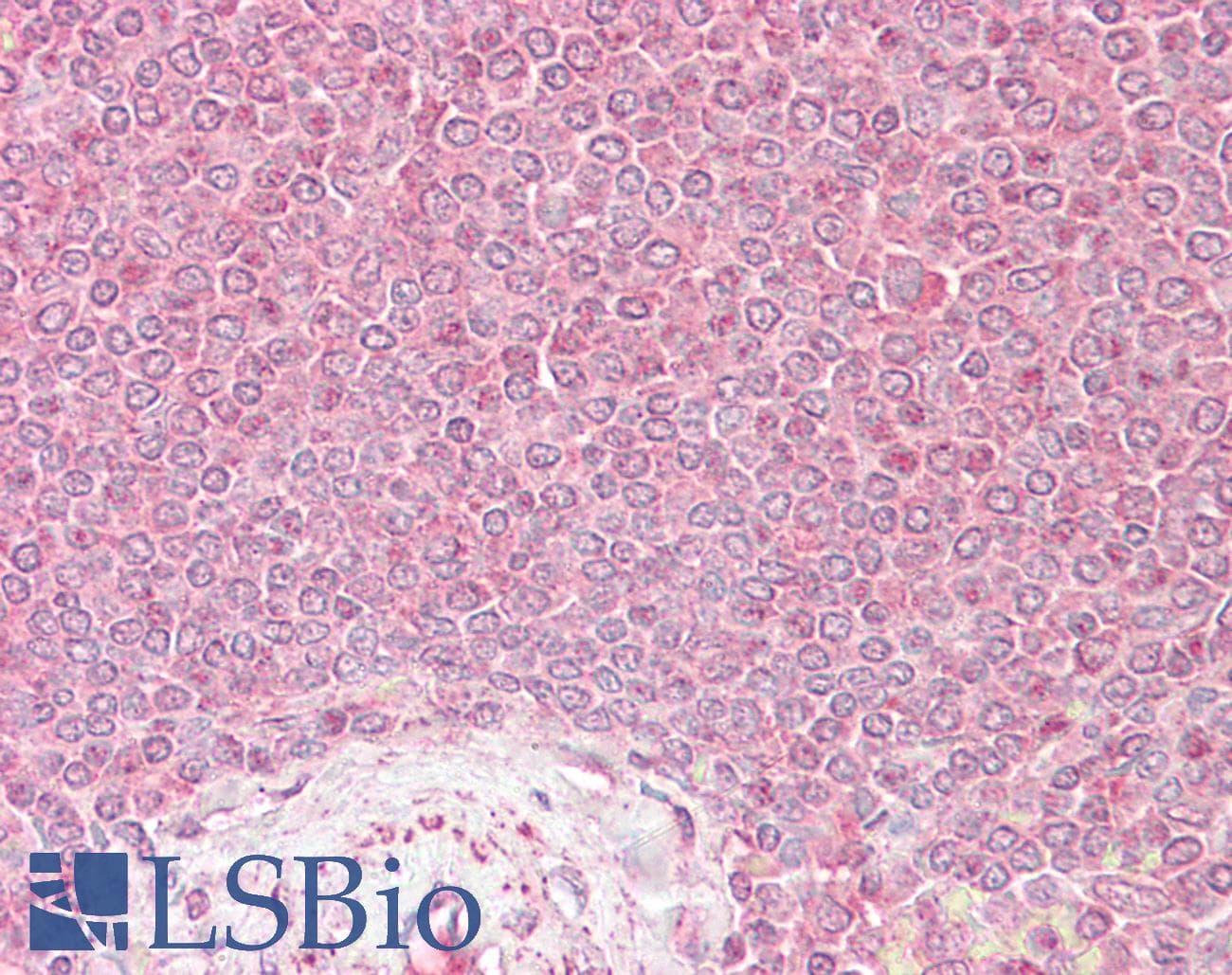 IHC-plus™ VPS45 Antibody (aa294-307)