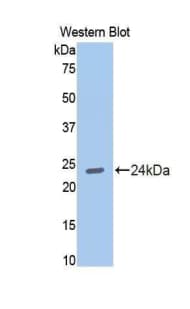 CDH2 / N Cadherin Antibody (aa384-562, APC)