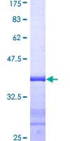 Human CETN1 Protein (Recombinant GST, N-terminus)