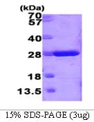 Mouse GSTM1 Protein (Recombinant)