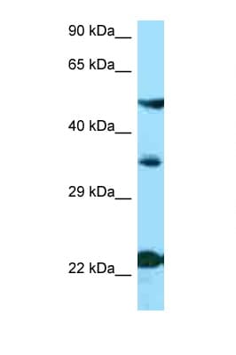 MC4R / Melanocortin 4 Receptor Antibody (N-Terminus)