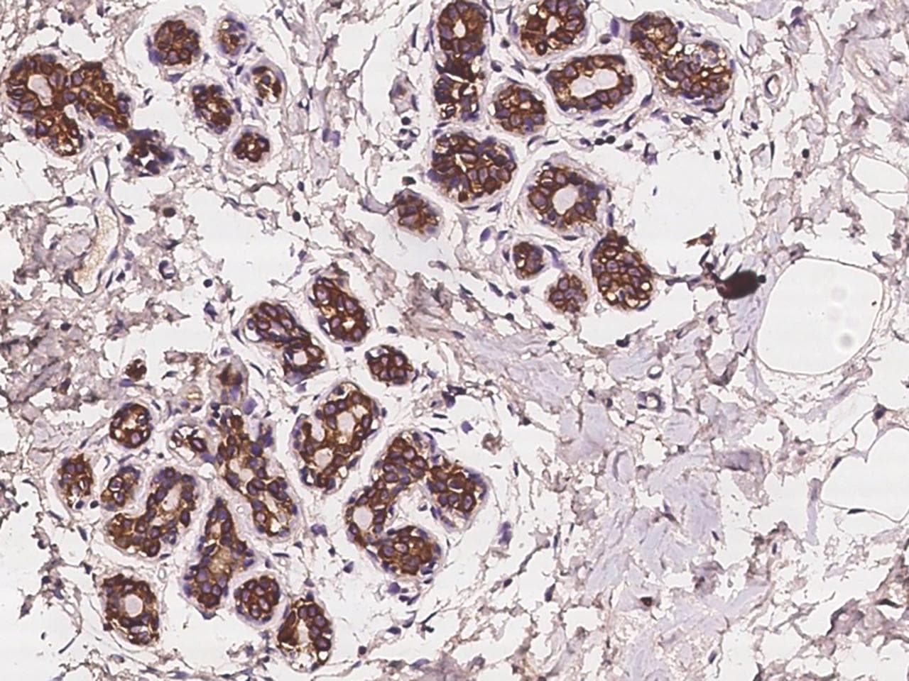 ANKRD30B Antibody