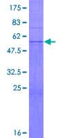 Human UBC6 / UBE2J2 Protein (Recombinant GST)