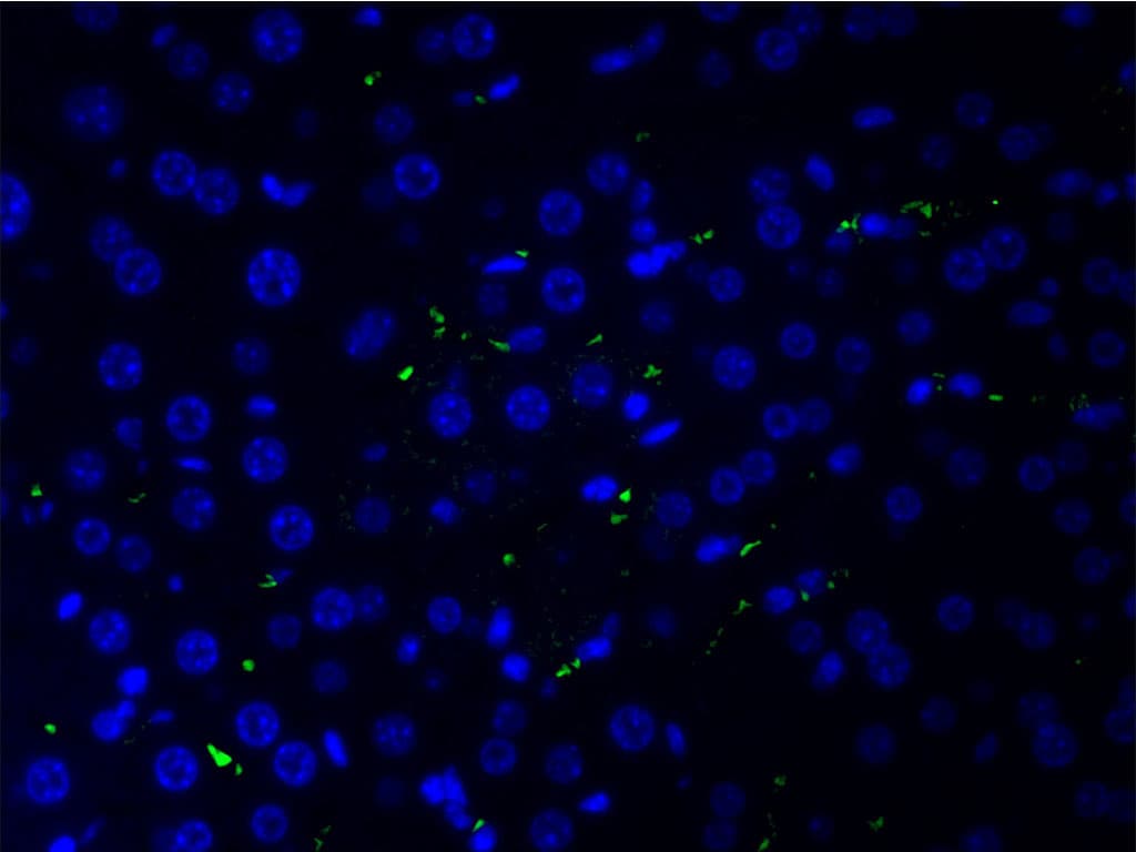 Polyclonal Rabbit anti-Human COL2A1 / Collagen II Alpha 1 Antibody (IHC, IF, WB)